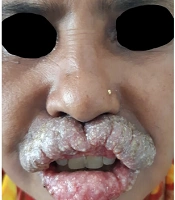J Skin Stem Cell